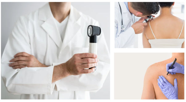 Drei Szenen vom Hautscreening: Dermatoskop, Untersuchung mit Otoskop und Markierung auf dem Rücken