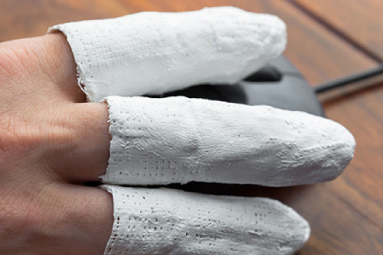 Finger in Gips an einer Computermaus