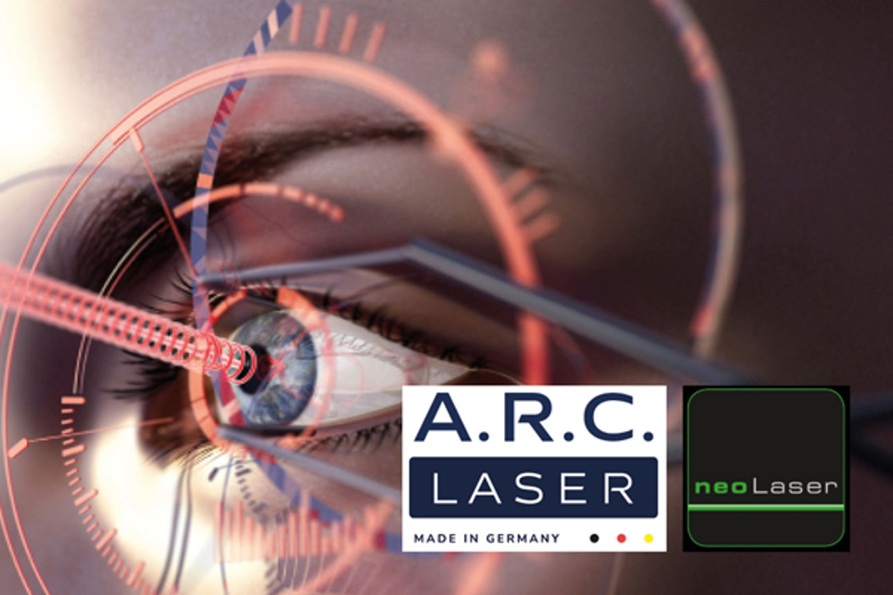 Bildliche Darstellung einer Augenlaserung