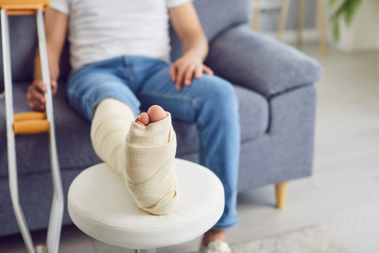 Fuß im Gips.