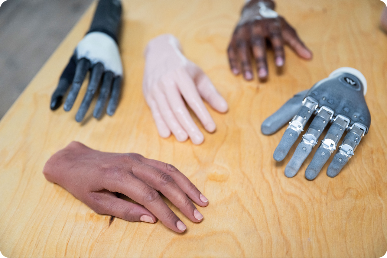 Auf einem Holztisch liegen verschiedene Teile für Handprothesen